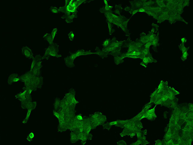 AFAP1L2 Antibody in Immunocytochemistry (ICC/IF)