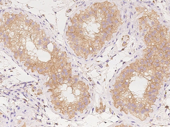 AP2A2 Antibody in Immunohistochemistry (Paraffin) (IHC (P))