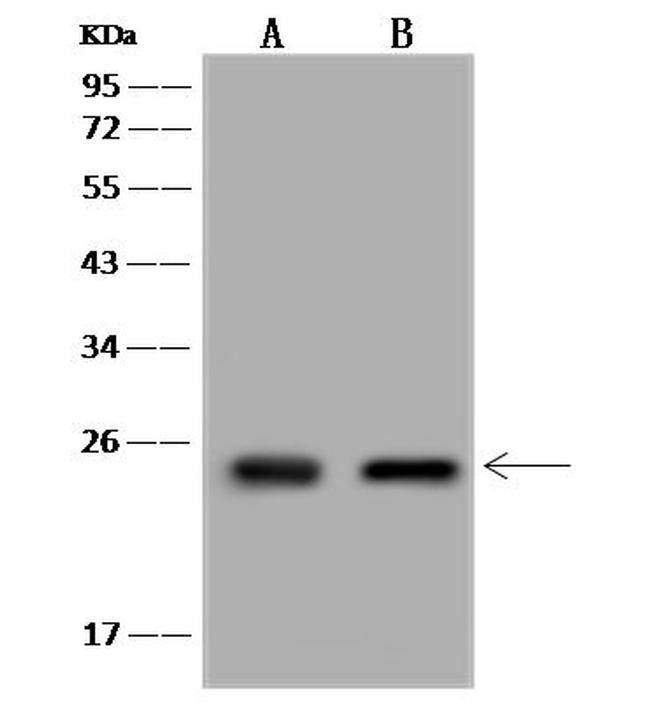 ARFRP1 Antibody in Western Blot (WB)