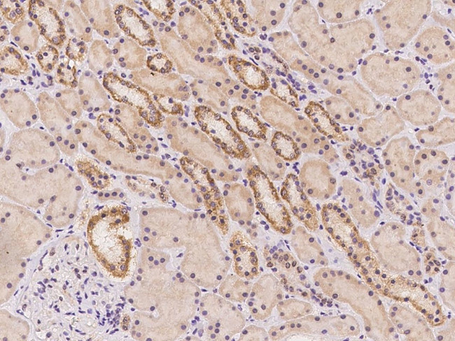 ARHGAP19 Antibody in Immunohistochemistry (Paraffin) (IHC (P))