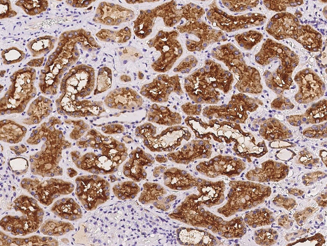 ATP6V1D Antibody in Immunohistochemistry (Paraffin) (IHC (P))