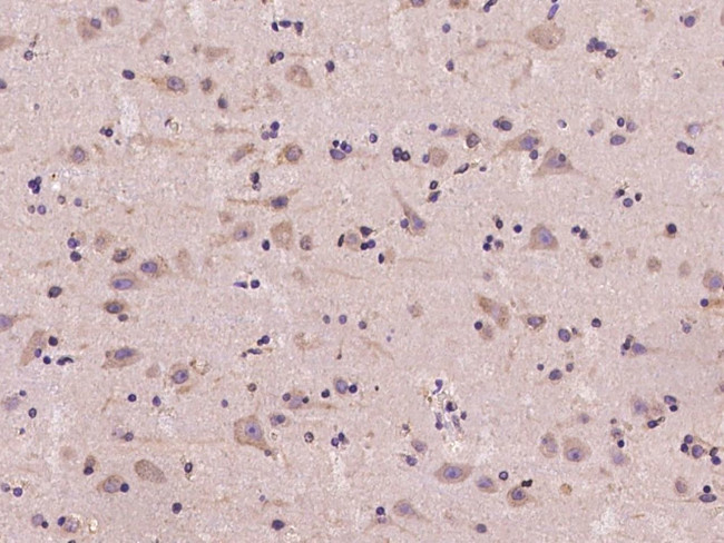 AUP1 Antibody in Immunohistochemistry (Paraffin) (IHC (P))