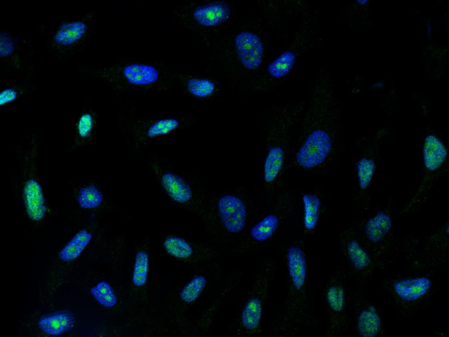BOP1 Antibody in Immunocytochemistry (ICC/IF)