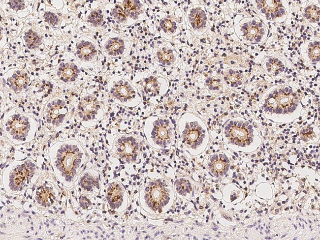C3orf38 Antibody in Immunohistochemistry (Paraffin) (IHC (P))