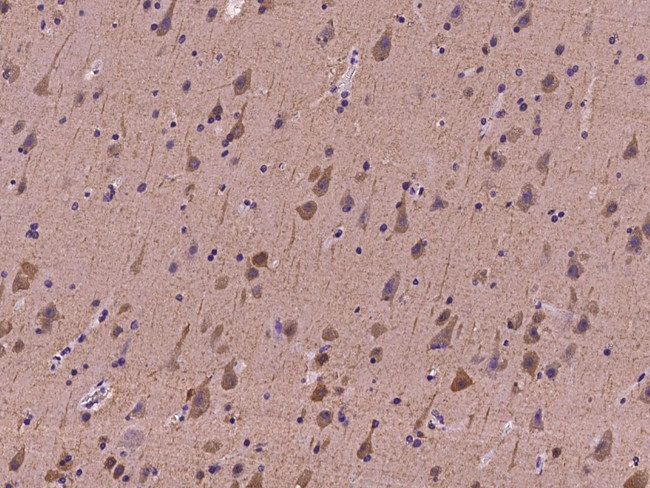 CABP5 Antibody in Immunohistochemistry (Paraffin) (IHC (P))