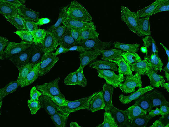 Caldesmon Antibody in Immunocytochemistry (ICC/IF)