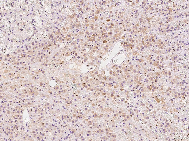 CaMKII alpha Antibody in Immunohistochemistry (Paraffin) (IHC (P))