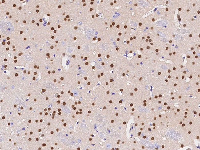 CaMKIV Antibody in Immunohistochemistry (Paraffin) (IHC (P))