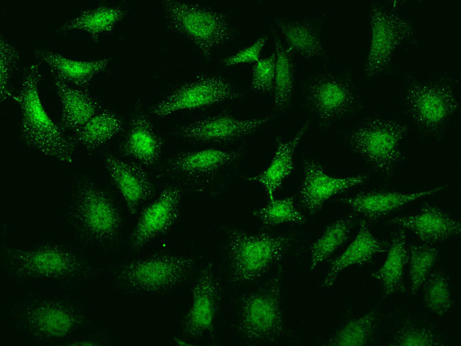 CaMKV Antibody in Immunocytochemistry (ICC/IF)