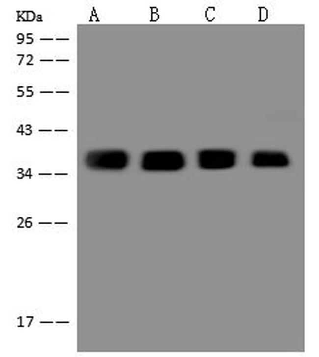 CAPZA2 Antibody in Western Blot (WB)