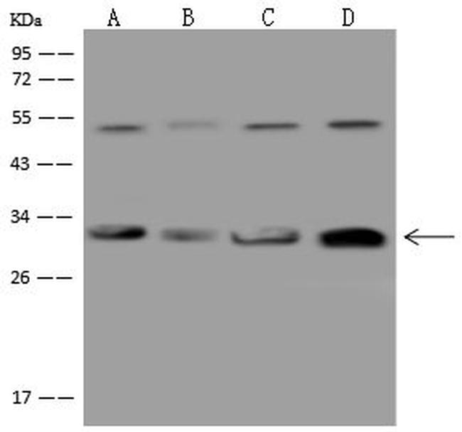 CAPZB Antibody in Western Blot (WB)