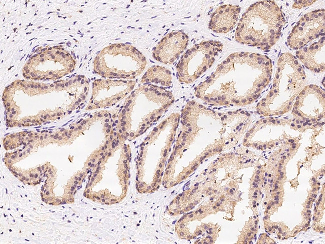 CBWD1 Antibody in Immunohistochemistry (Paraffin) (IHC (P))