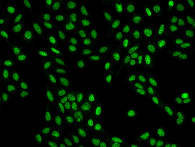 CCAR1 Antibody in Immunocytochemistry (ICC/IF)