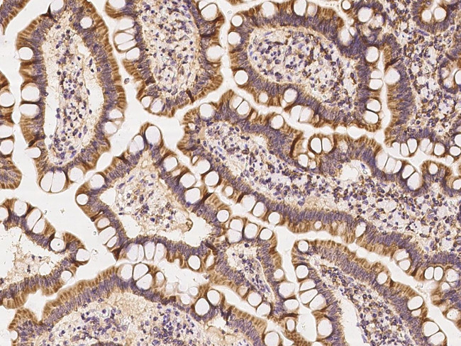 CCDC47 Antibody in Immunohistochemistry (Paraffin) (IHC (P))