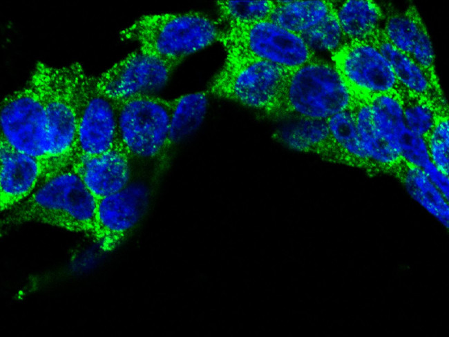 CCR3 Antibody in Immunocytochemistry (ICC/IF)