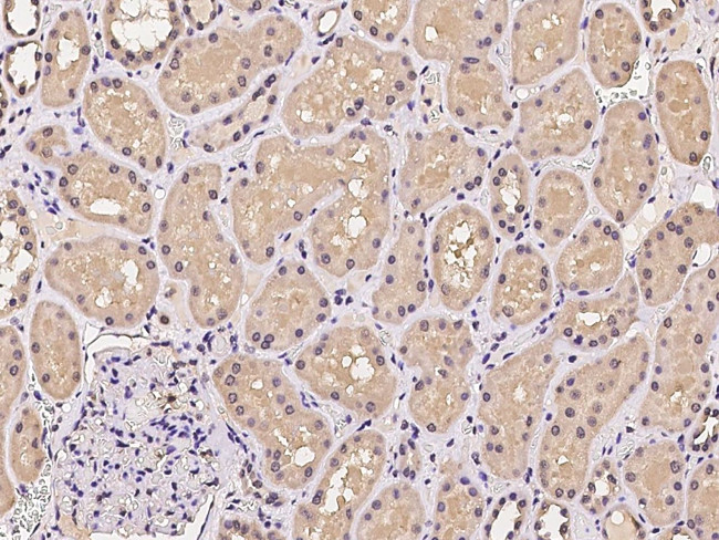 Cdc34 Antibody in Immunohistochemistry (Paraffin) (IHC (P))