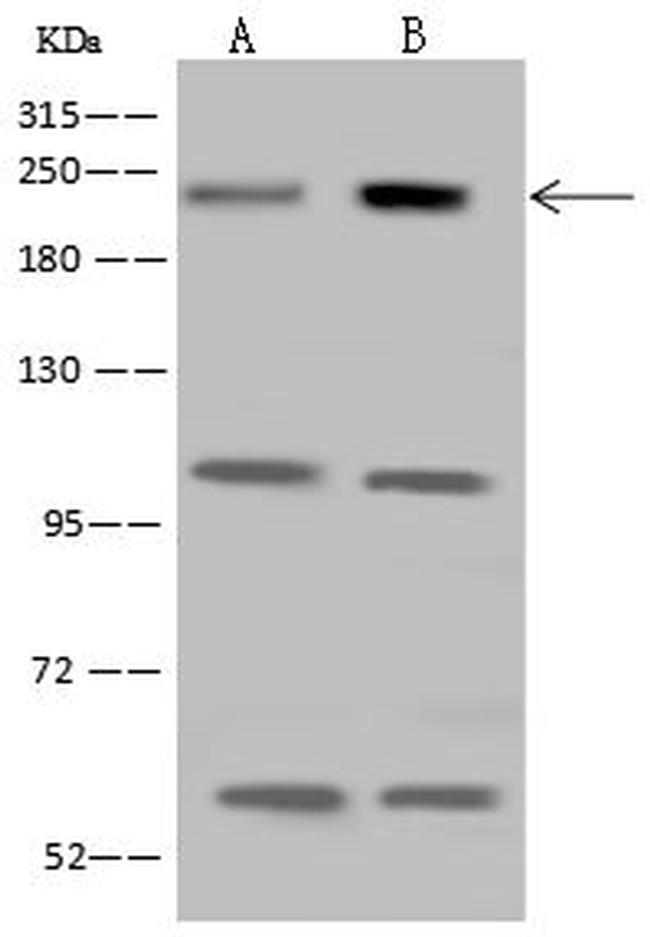 MRCK beta Antibody in Western Blot (WB)