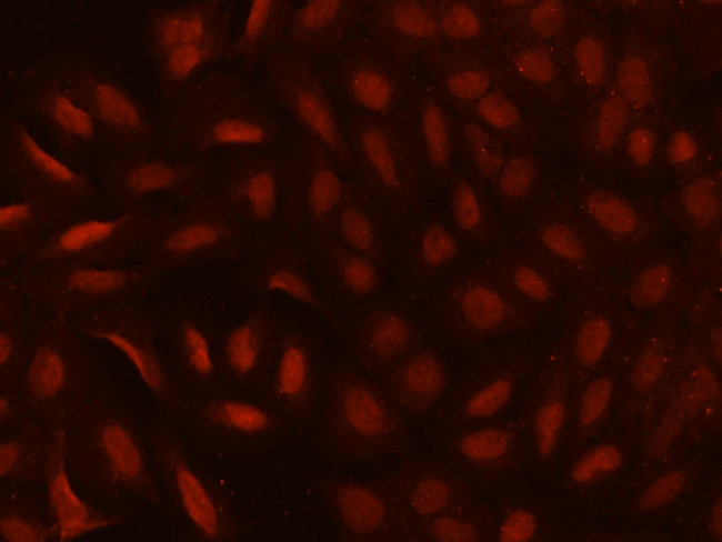 CDYL Antibody in Immunocytochemistry (ICC/IF)