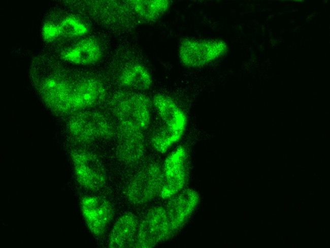 CHERP Antibody in Immunocytochemistry (ICC/IF)