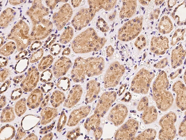 CHMP5 Antibody in Immunohistochemistry (Paraffin) (IHC (P))