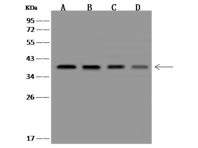 CLNS1A Antibody in Western Blot (WB)