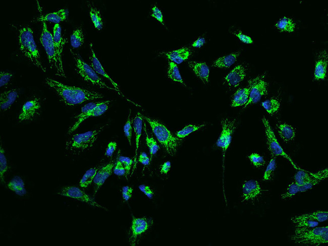 CLPP Antibody in Immunocytochemistry (ICC/IF)