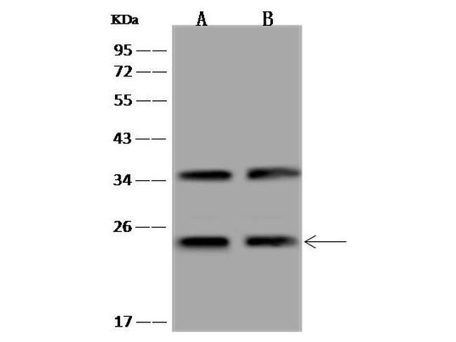 COMMD9 Antibody in Western Blot (WB)