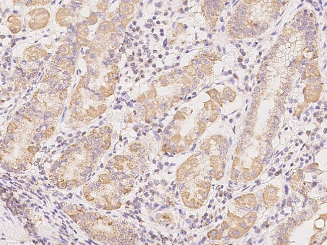CSK Antibody in Immunohistochemistry (Paraffin) (IHC (P))