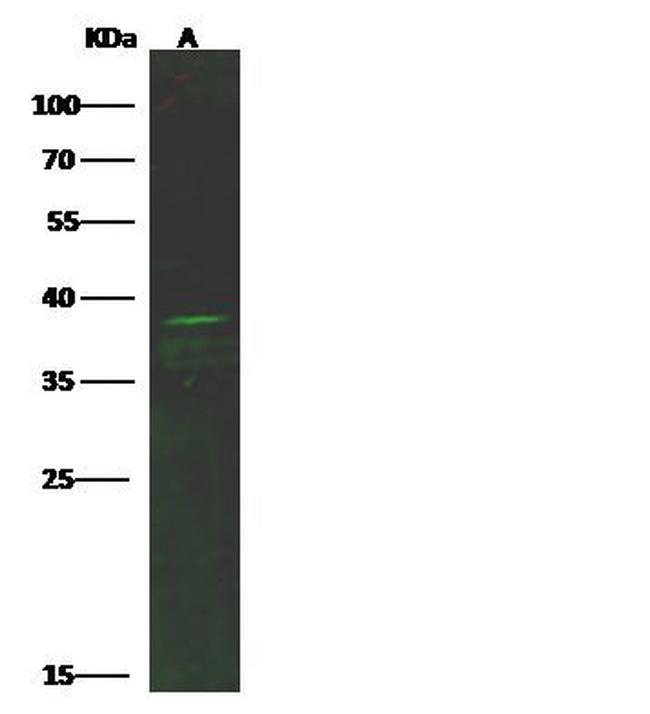 CXCR6 Antibody in Western Blot (WB)