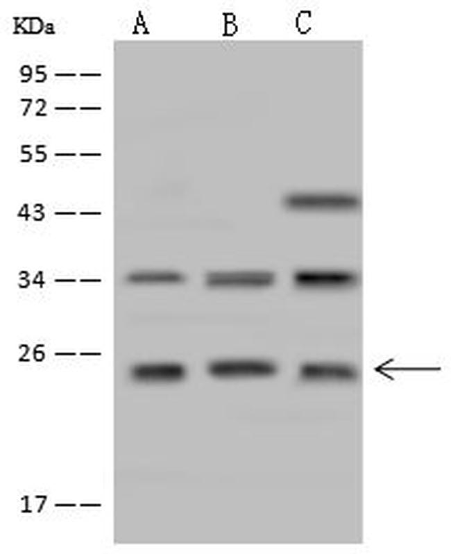 CYB561D1 Antibody in Western Blot (WB)