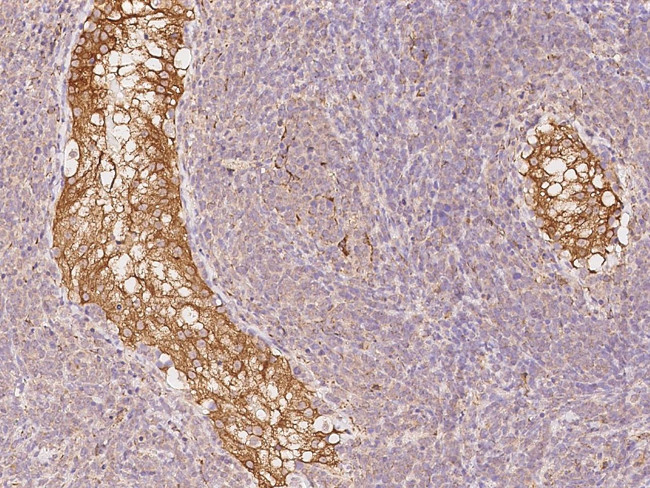 CYB5R3 Antibody in Immunohistochemistry (Paraffin) (IHC (P))