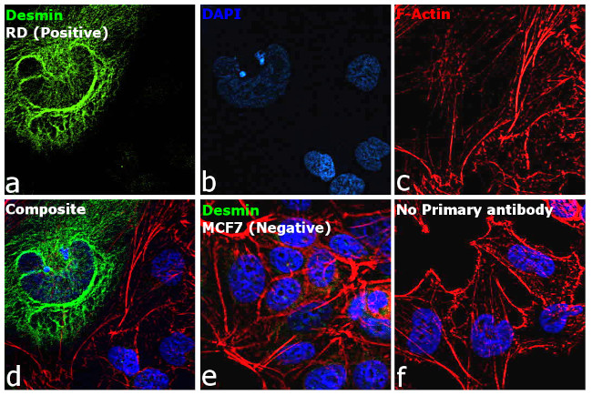 Desmin Antibody in Immunocytochemistry (ICC/IF)