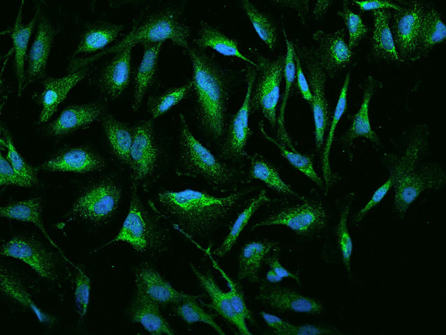 DLD Antibody in Immunocytochemistry (ICC/IF)