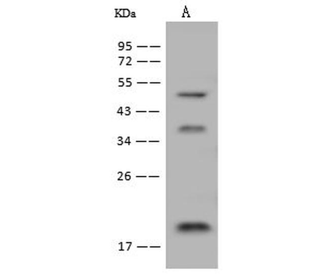 DNAJC24 Antibody in Western Blot (WB)