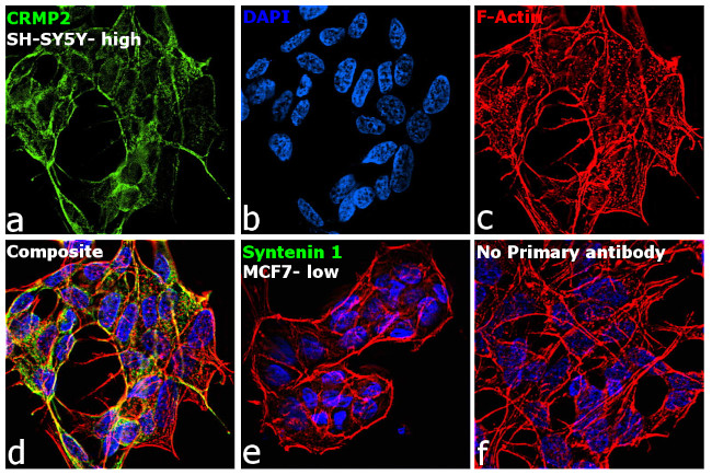 CRMP2 Antibody in Immunocytochemistry (ICC/IF)