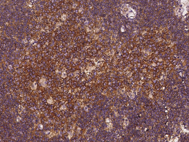 EPS15 Antibody in Immunohistochemistry (Paraffin) (IHC (P))