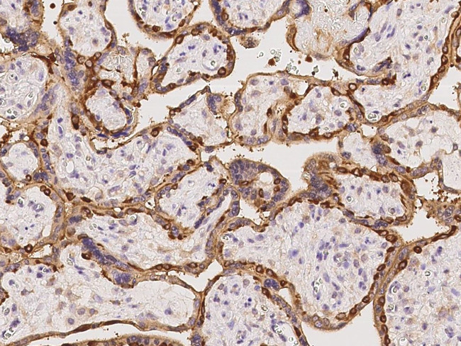 EPS8L2 Antibody in Immunohistochemistry (Paraffin) (IHC (P))