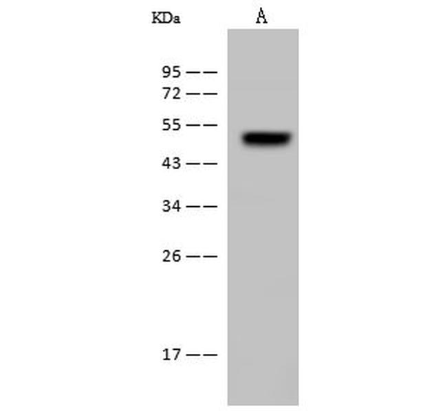 FADS3 Antibody in Western Blot (WB)