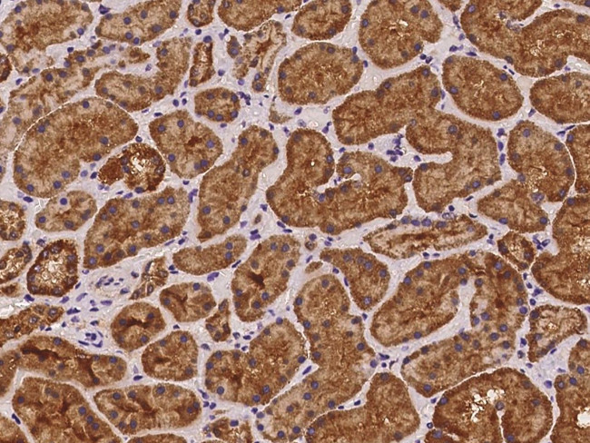 FHIT Antibody in Immunohistochemistry (Paraffin) (IHC (P))