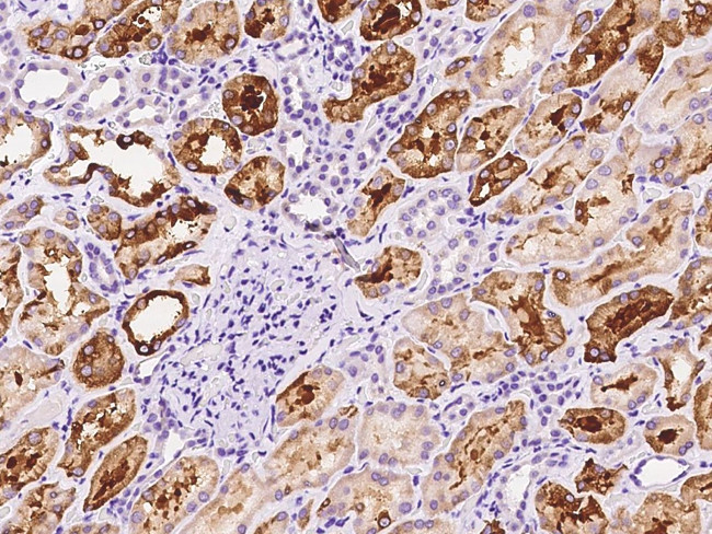 FIGNL1 Antibody in Immunohistochemistry (Paraffin) (IHC (P))