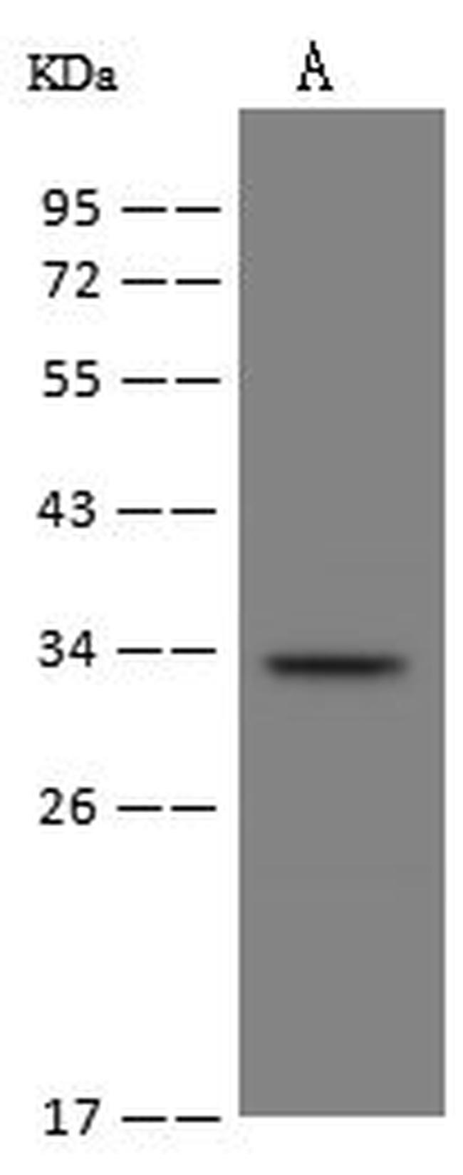 FN3KRP Antibody in Western Blot (WB)