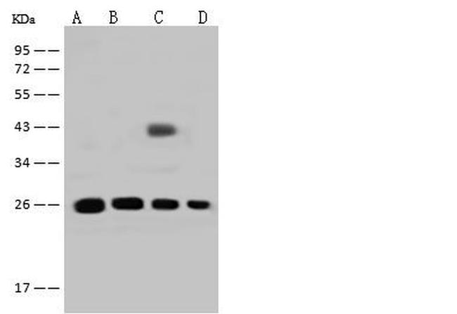 GSTT2B Antibody in Western Blot (WB)