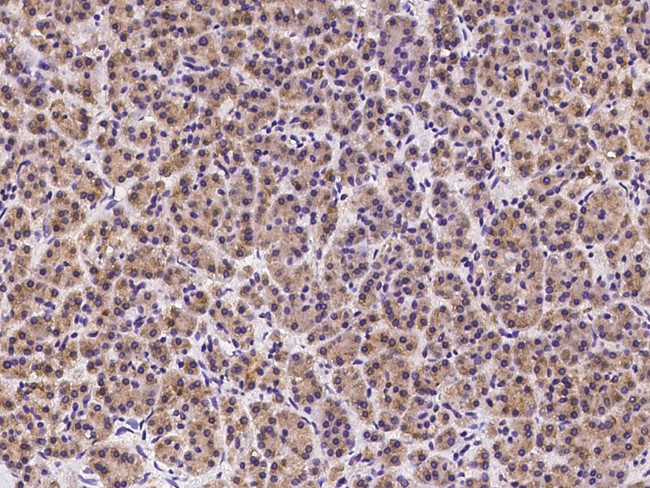 HDLBP Antibody in Immunohistochemistry (Paraffin) (IHC (P))