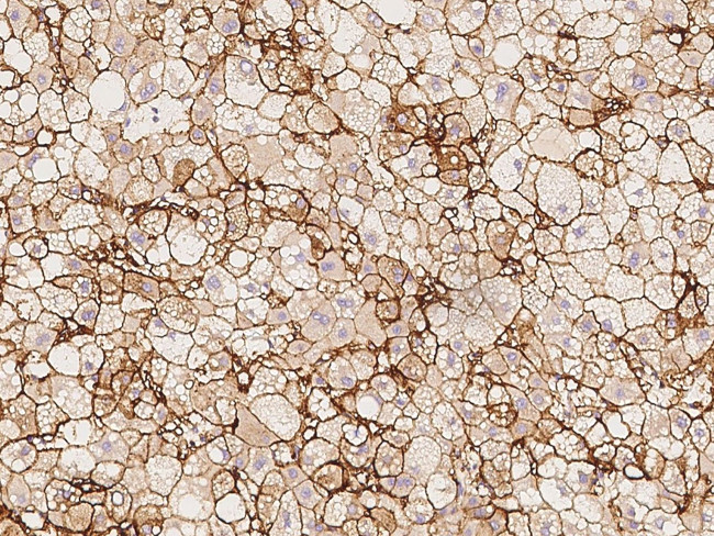 HLA-B27 Antibody in Immunohistochemistry (Paraffin) (IHC (P))