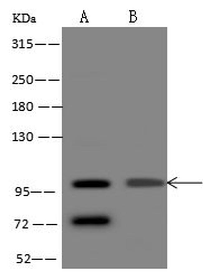 HSPA4 Antibody in Western Blot (WB)