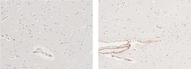 ICAM-1 Antibody in Immunohistochemistry (Paraffin) (IHC (P))