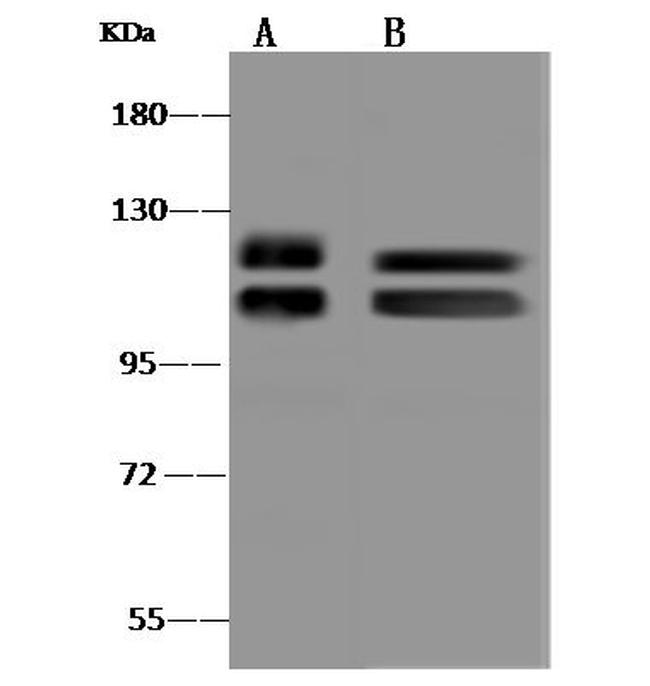 IDE Antibody in Western Blot (WB)