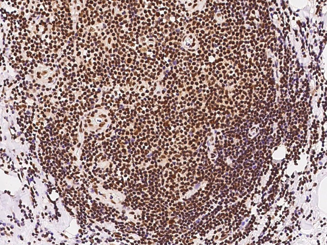 ILKAP Antibody in Immunohistochemistry (Paraffin) (IHC (P))