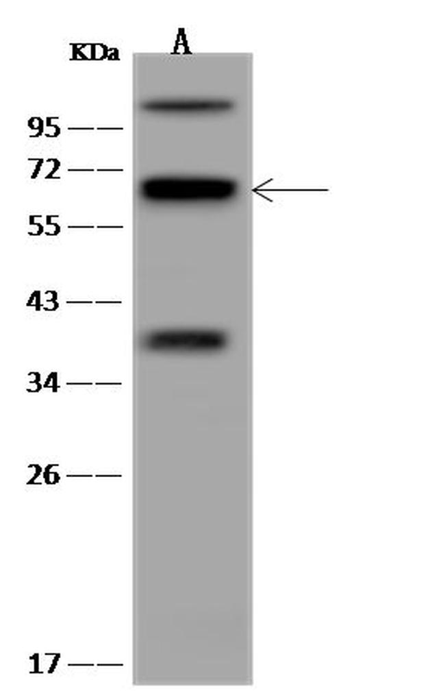 CPSF3L Antibody in Western Blot (WB)