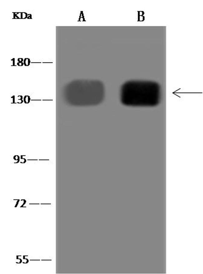 ITGA5 Antibody in Western Blot (WB)
